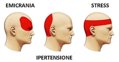 farmaci per la malattia della testa